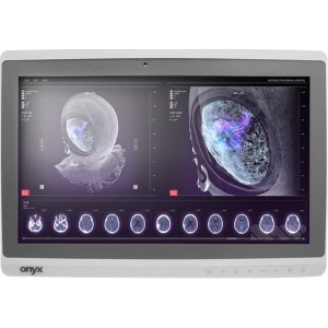 Onyx-Zeus-248 Professional Medical AIO i7-6500U/8GB/250GB SSD *TouchScreen* *No Stand*
